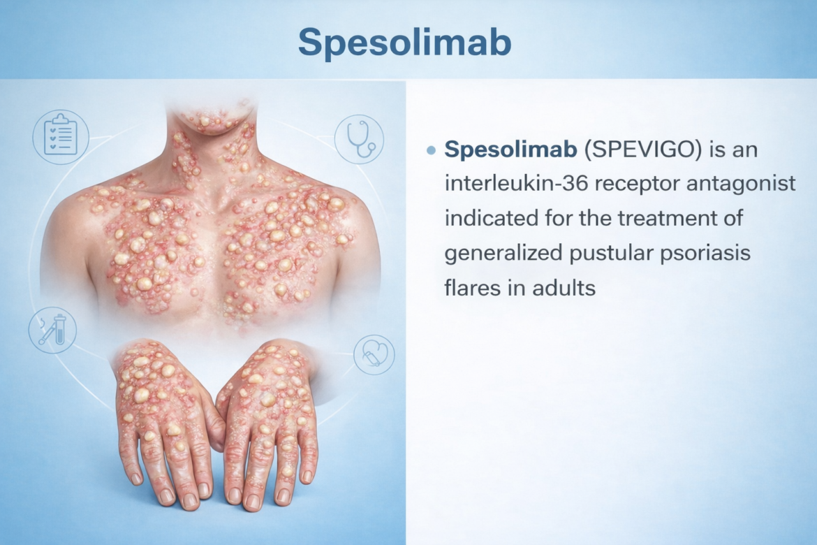 Spesolimab
